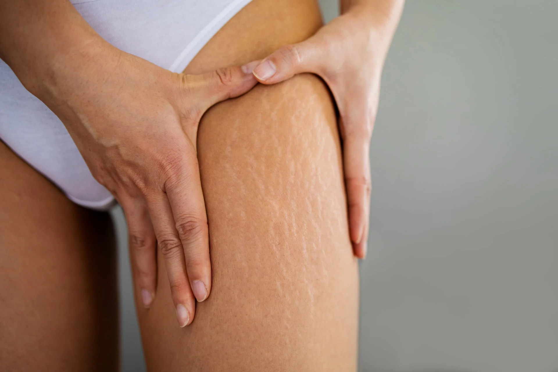 InWellness™ Anti-Cellulite 配图